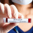 coronavirus sample getty - НИА